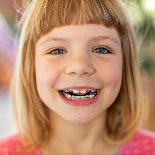 Children Orthodontics, Penticton Dental Care
