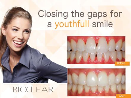 Bioclear, Penticton Dental Centre